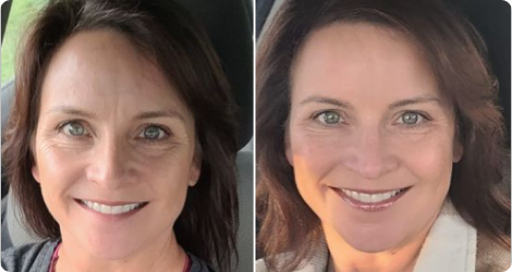 AgelessLX proven results weeks 2 to 3